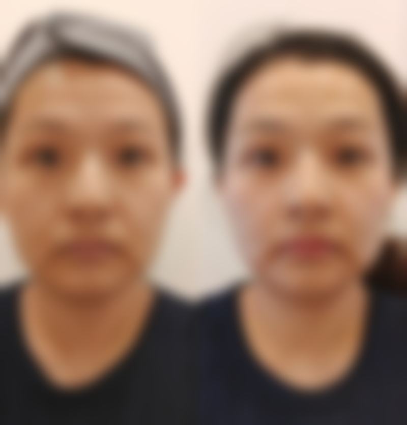 厦门姮美美容整形医院怎么预约挂号?