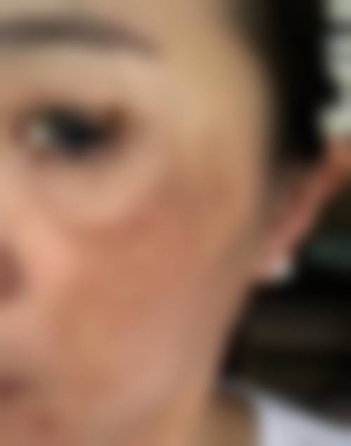 擅长项目详解杭州韩佳医疗整形门诊部袁世伟