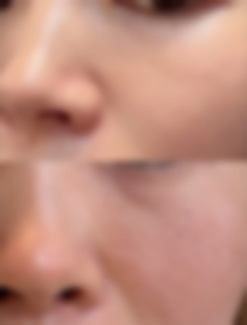 山西省中医院整形科诊疗设备好不好?