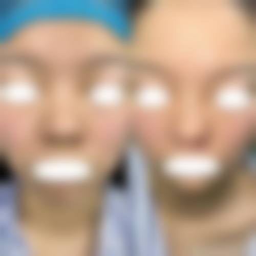 临床实例分享