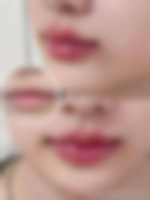 西安悦邦美医疗美容门诊部特色项目