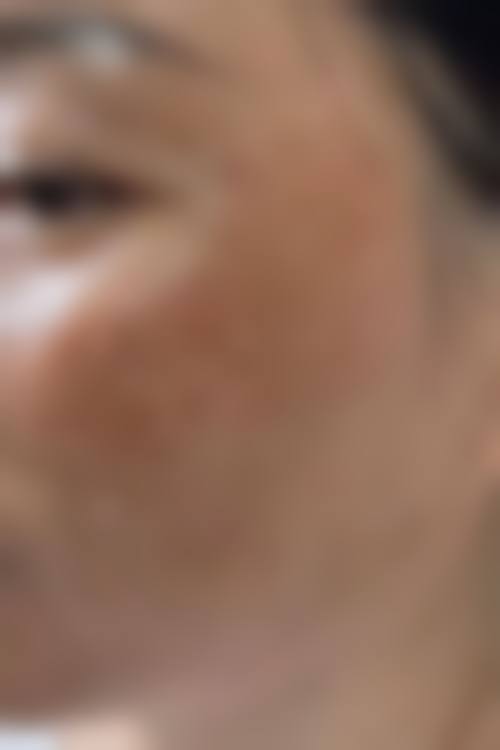 擅长项目详解:衡阳诺美医疗美容门诊部张爱君医生技术