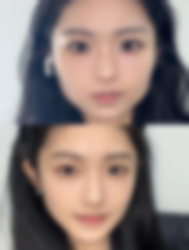 大连奈思美医疗整形医院参考价格表